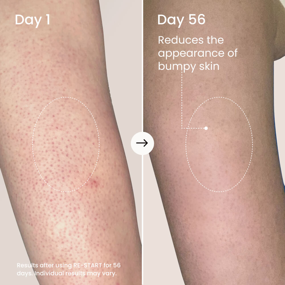 Resurfacing Body Serum product